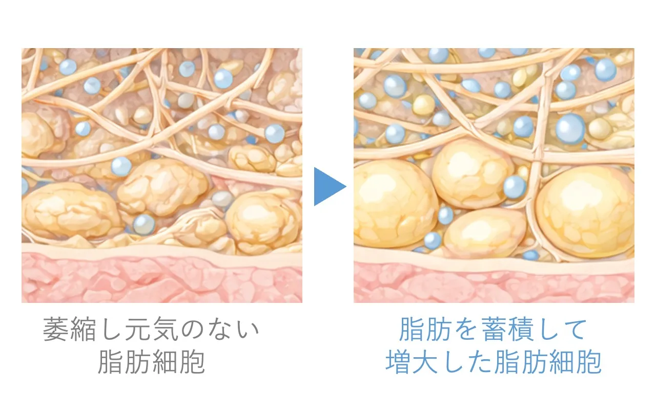 プロファイロ ストラクチュラの効果②脂肪細胞の増大｜フェイス美容外科 仙台【頬コケ・ジョールファット・フェイスラインのもたつき】