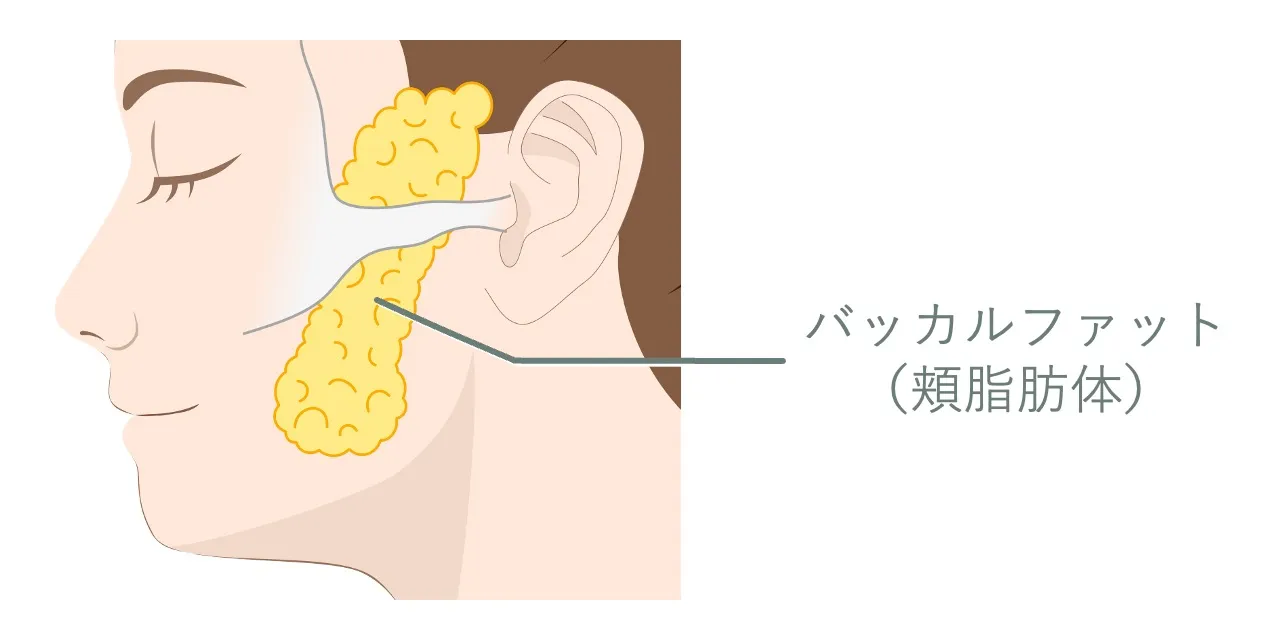バッカルファット（頬脂肪体）の位置