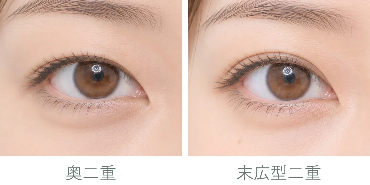 二重のタイプ｜二重のラインが見えるか見えないかくらいの奥二重と、二重の開始ポイントが目頭にくっついている末広型二重