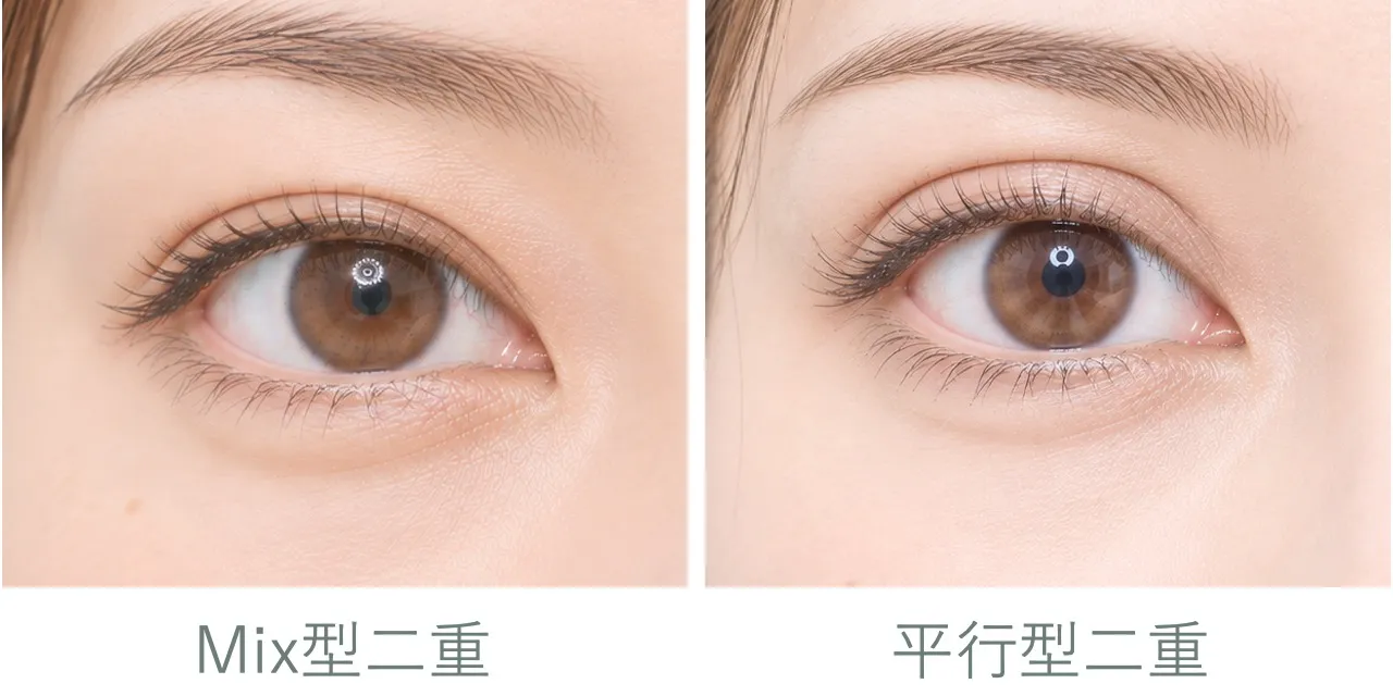 二重のタイプ｜目頭の二重の開始ポイントが目頭とくっつくかくっつかないかくらいのmix型二重と、目頭の二重ラインの開始ポイントが目頭から完全に離れている平行型二重