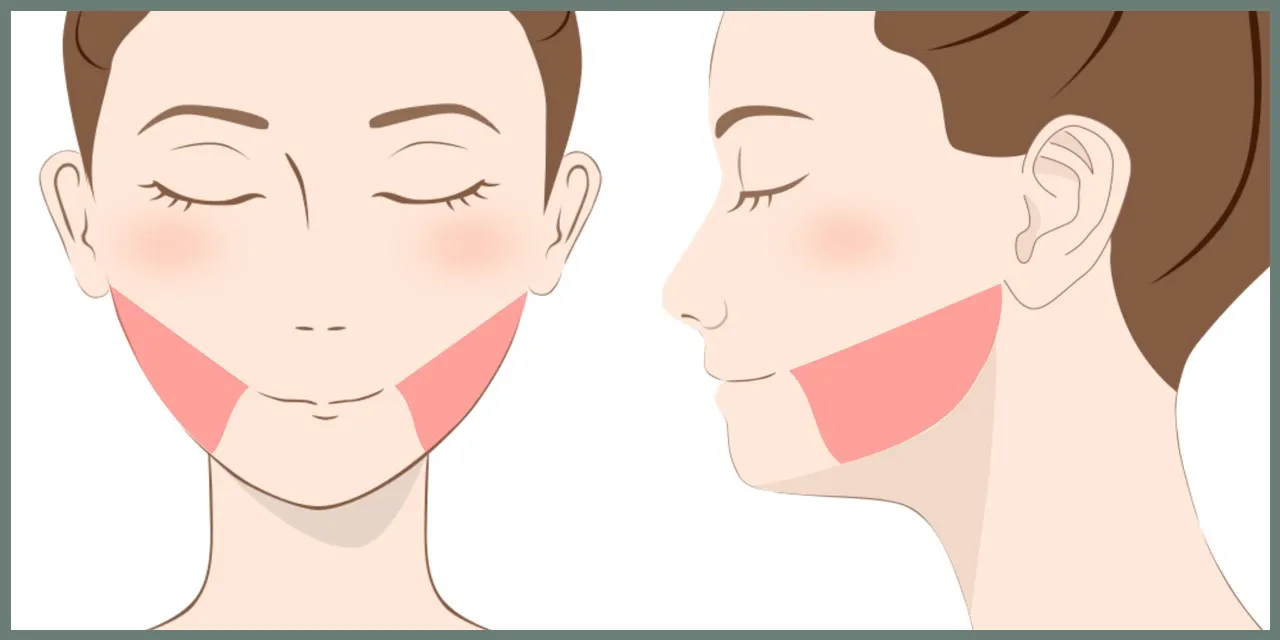 頬の脂肪吸引の範囲