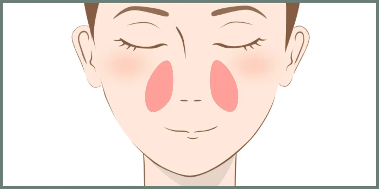 メーラーファット（ほうれい線外側）の脂肪吸引の範囲