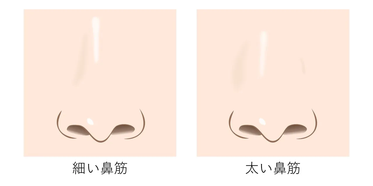 細い鼻筋と太い鼻筋の比較