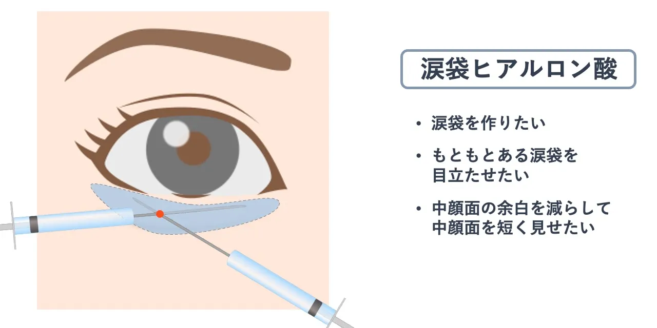 涙袋ヒアルロン酸
