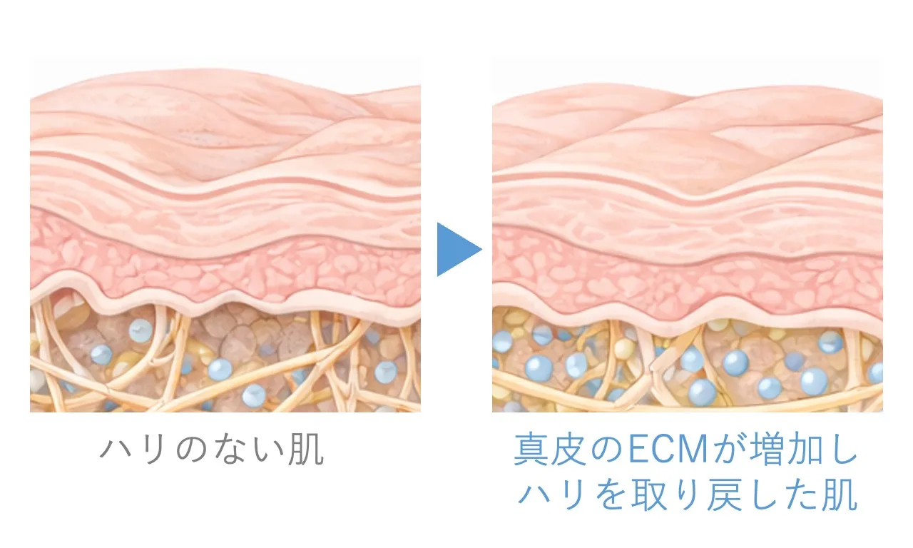プロファイロ ストラクチュラ 作用のメカニズム③｜真皮細胞外マトリックス（ECM）の再構築作用に伴う肌質の改善