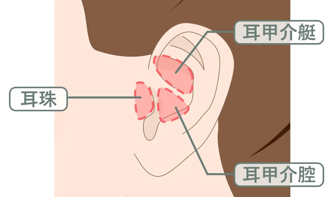 鼻尖への軟骨移植における軟骨の採取部|耳甲介艇(耳甲介舟)と耳甲介腔