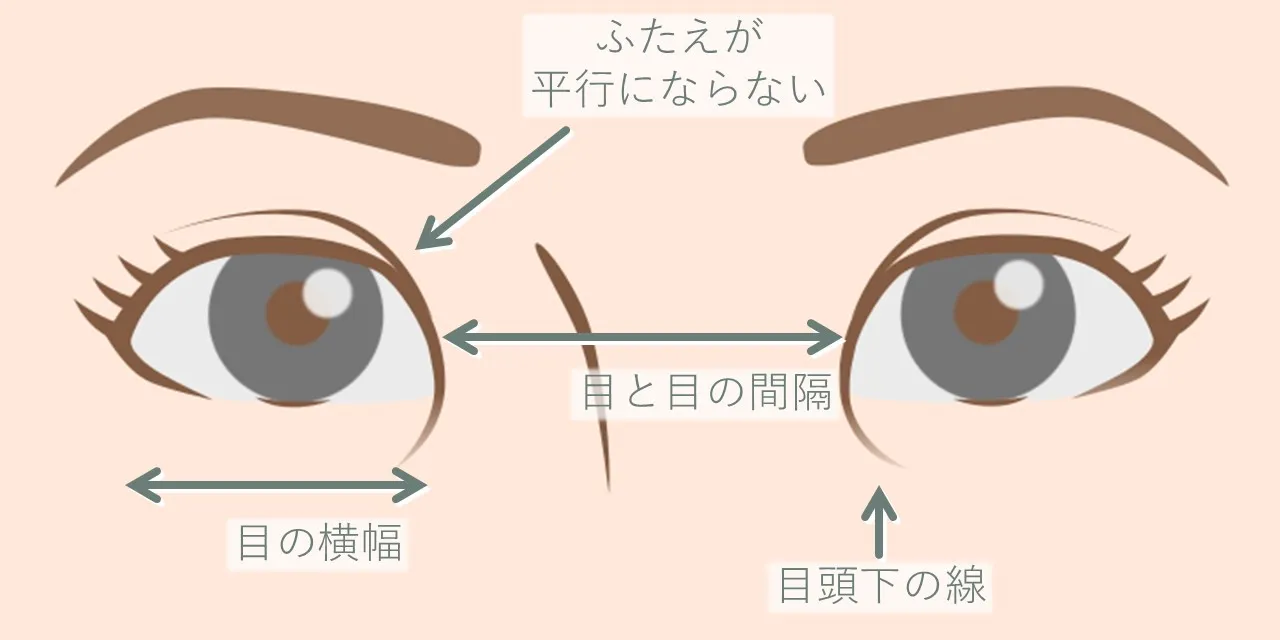 蒙古ひだによって引き起こされる変化、お悩み、症状