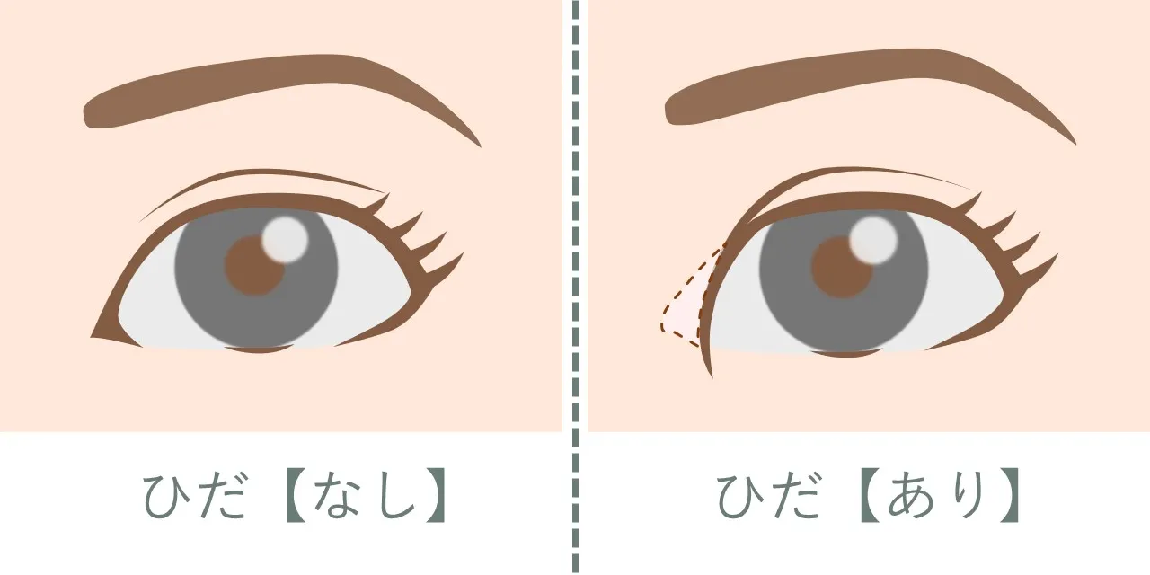 蒙古ひだの有無による目の形の違いと印象の違い
