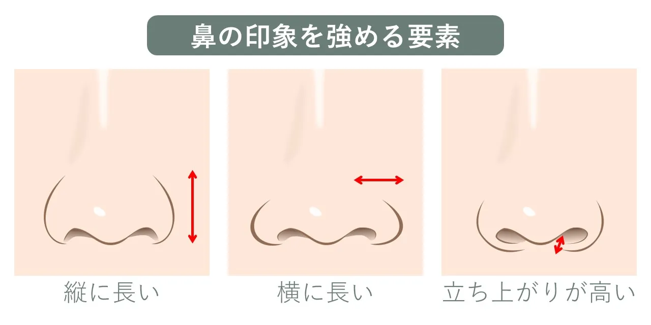 鼻の印象を強める要素は小鼻の高さ、小鼻の幅、小鼻の立ち上がりの3つ